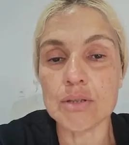  Mulher é desclassificada do Enem por utilizar aparelho para doença rara